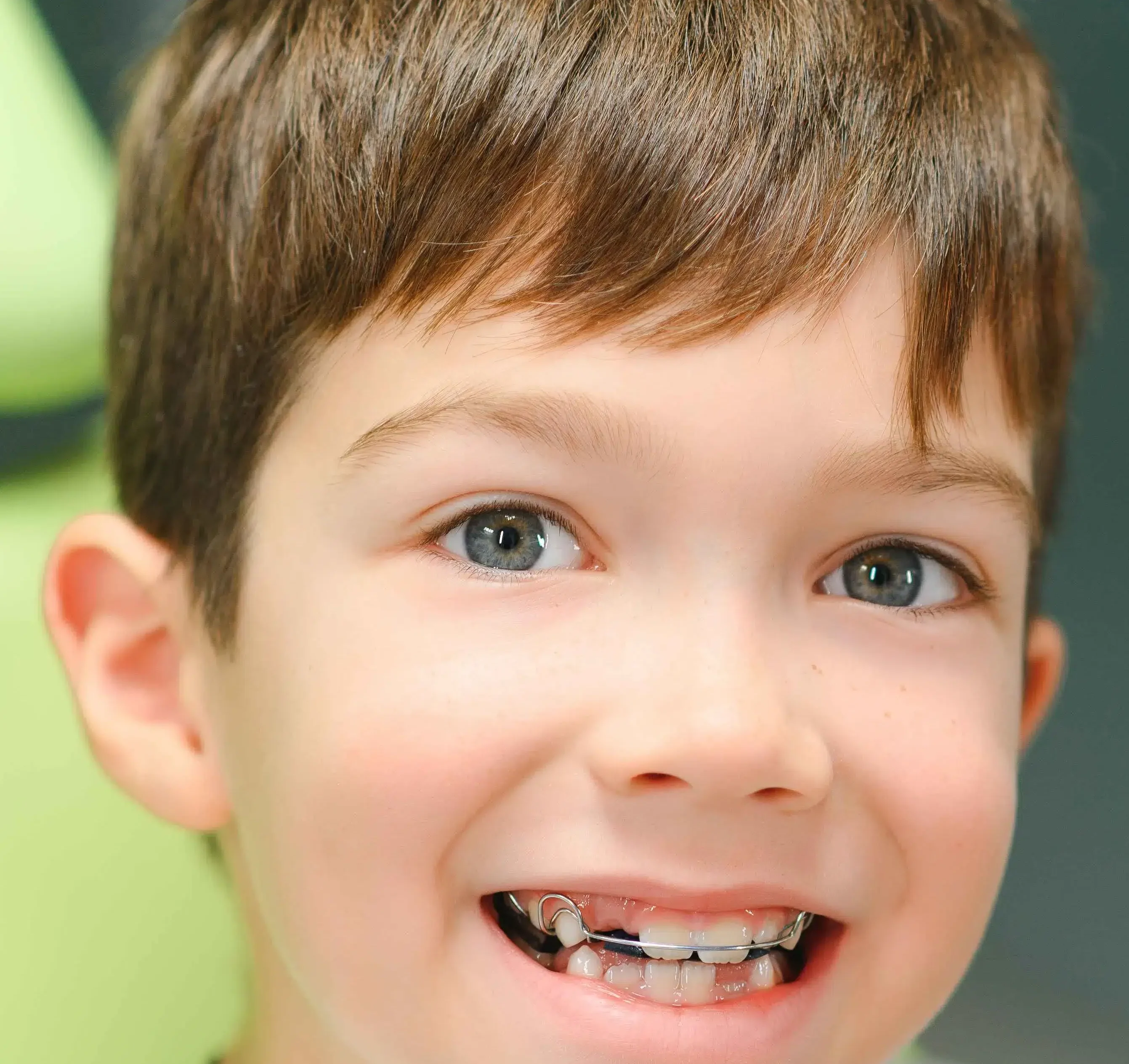 Yer tutucu nedir? Dent Bonova